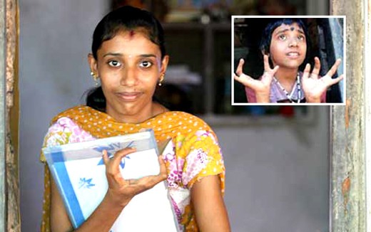 Endosulfan affected girl Shruthi braves all odds ; to pursue medical course